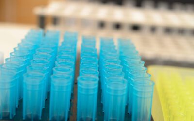 The Anti-SM Antibody: An Overview for Medical Professionals