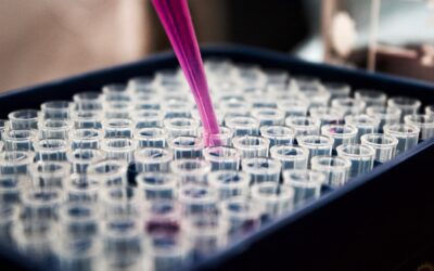 An Overview of Protein Assay Methods
