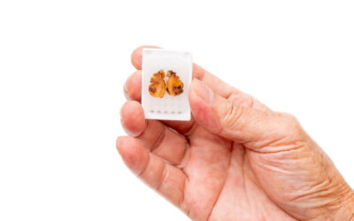 Unlock the Potential of Stored FFPE Tissue for Groundbreaking Research